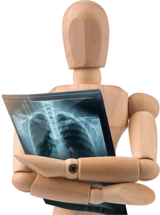 X-Rays in Eastbourne