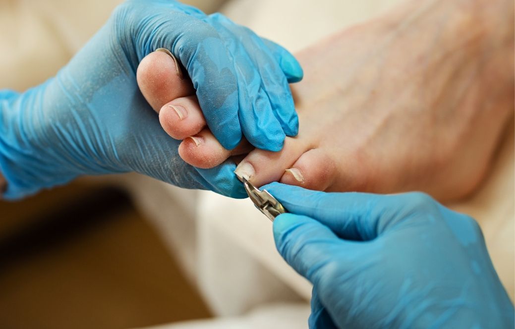 General foot care