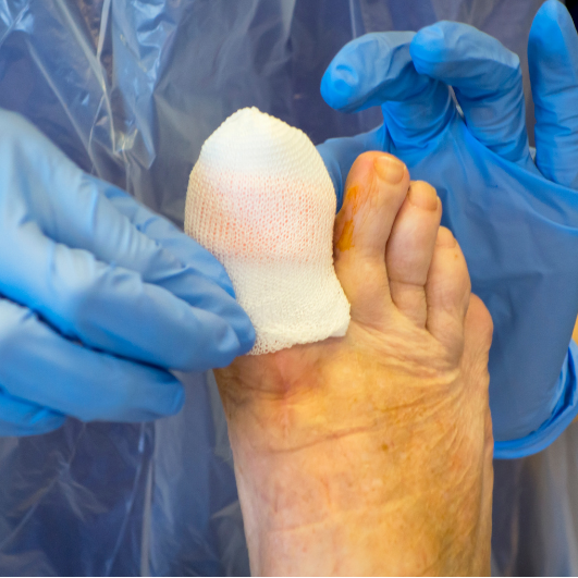 Nail surgery